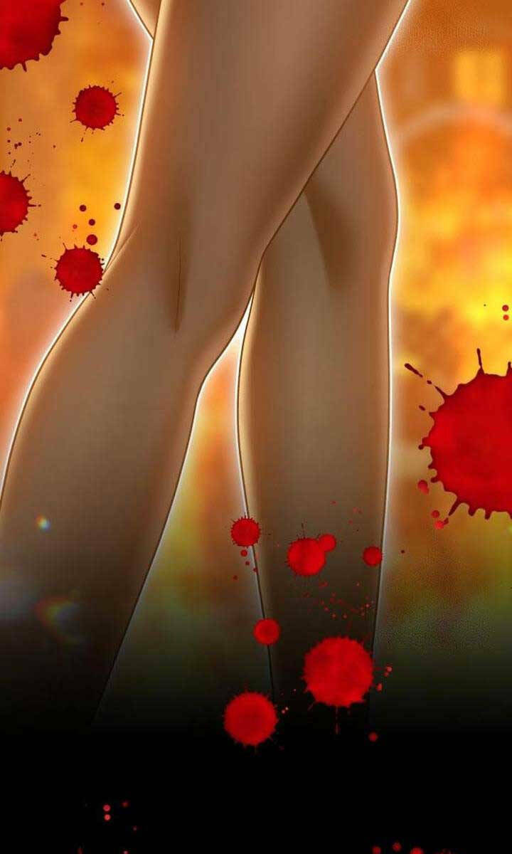 Chapter 55.6 trang 113