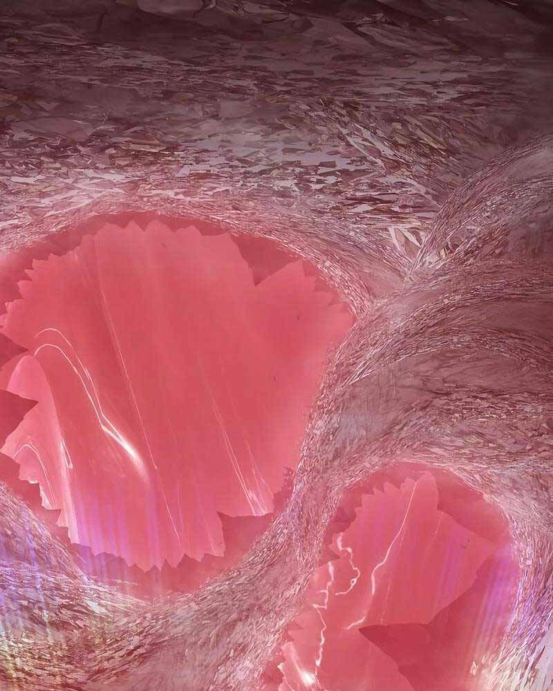 Chapter 82 trang 178